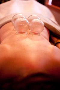 photosm_cupping