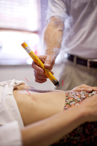 photosm_moxibustion